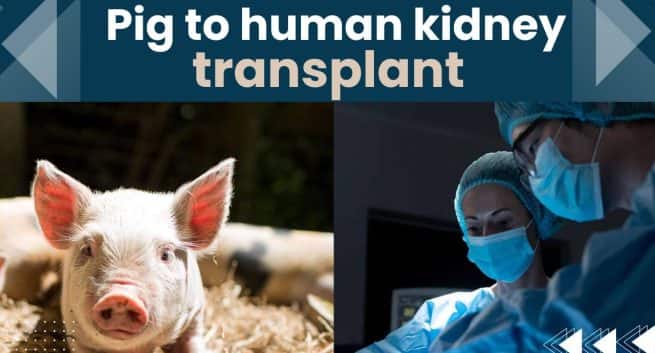Pig-to-Human kidney Transplant !