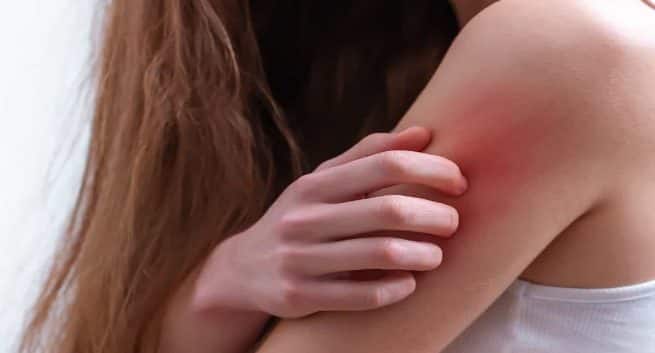 Do You Have Dry Skin Problem? Here’s A List Of Vitamins and Supplements To Help