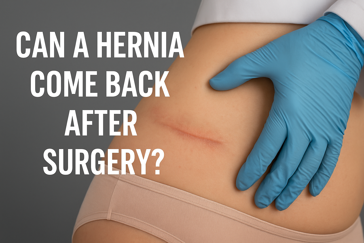 Can a Hernia Come Back After Surgery? Causes and Prevention