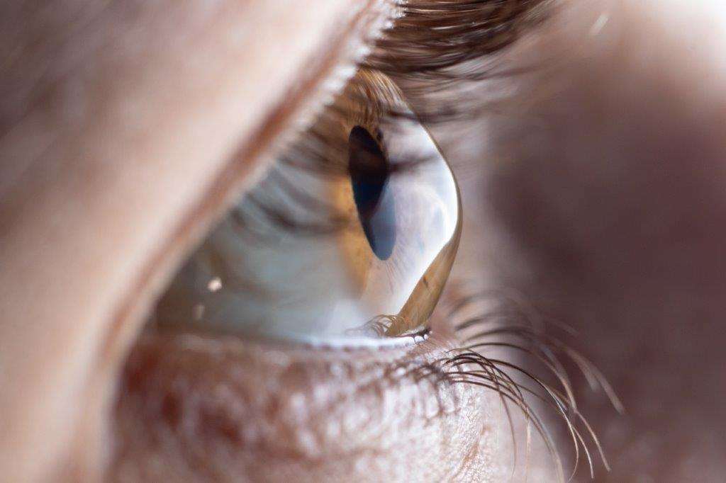 Seeing Clearly Again: Understanding Keratoconus and Advanced Treatments
